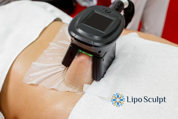 Does Fat Freezing at Home Work? DIY Devices vs Professional Cryolipolysis 1 How is professional cryolipolysis different St George?